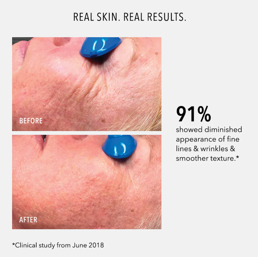 COLLAGEN REACTIVATE PM